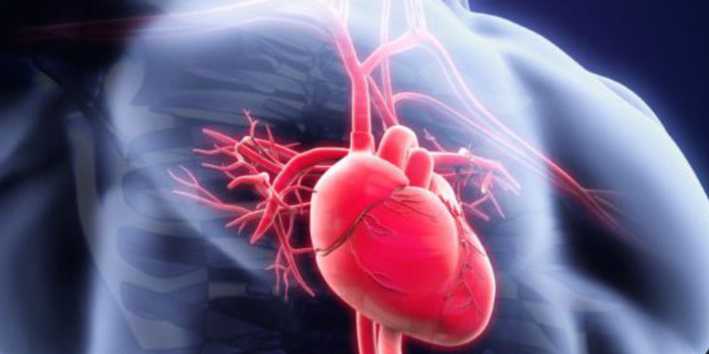 Ischemia