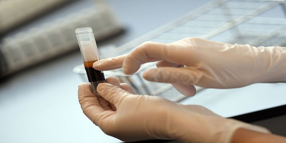 Coronavirus-Thousands to take part in plasma trial