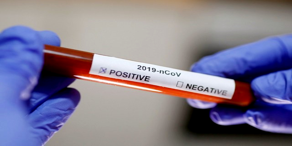 coronavirus
