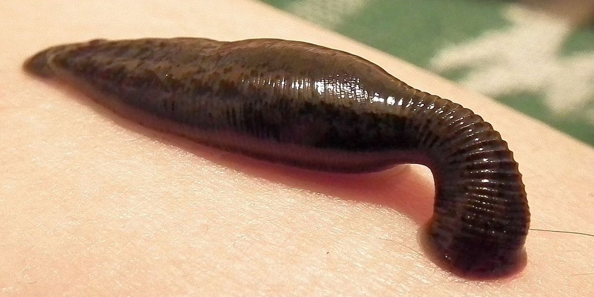 Doctors remove 3-cm long leech from the man's nostril in China