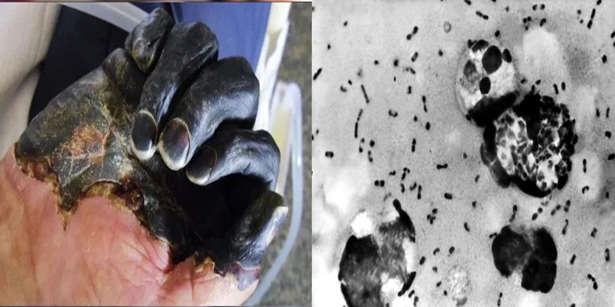 China reports cases of Bubonic plague, WHO monitoring the situation