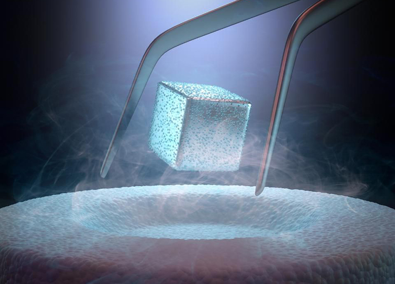 Superconductors