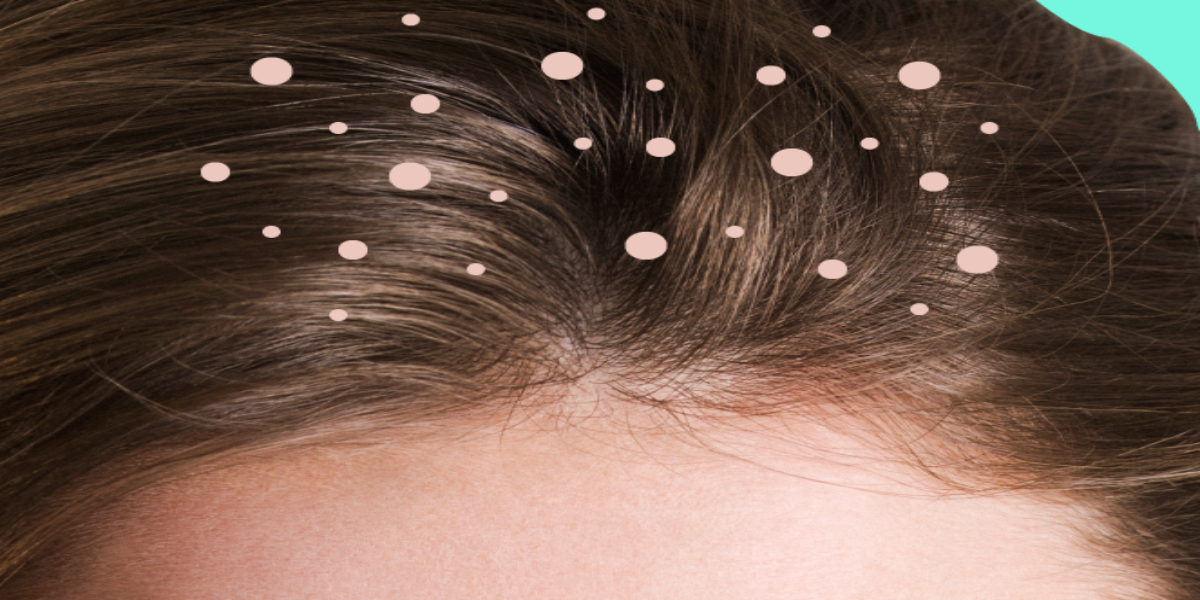 scalp
