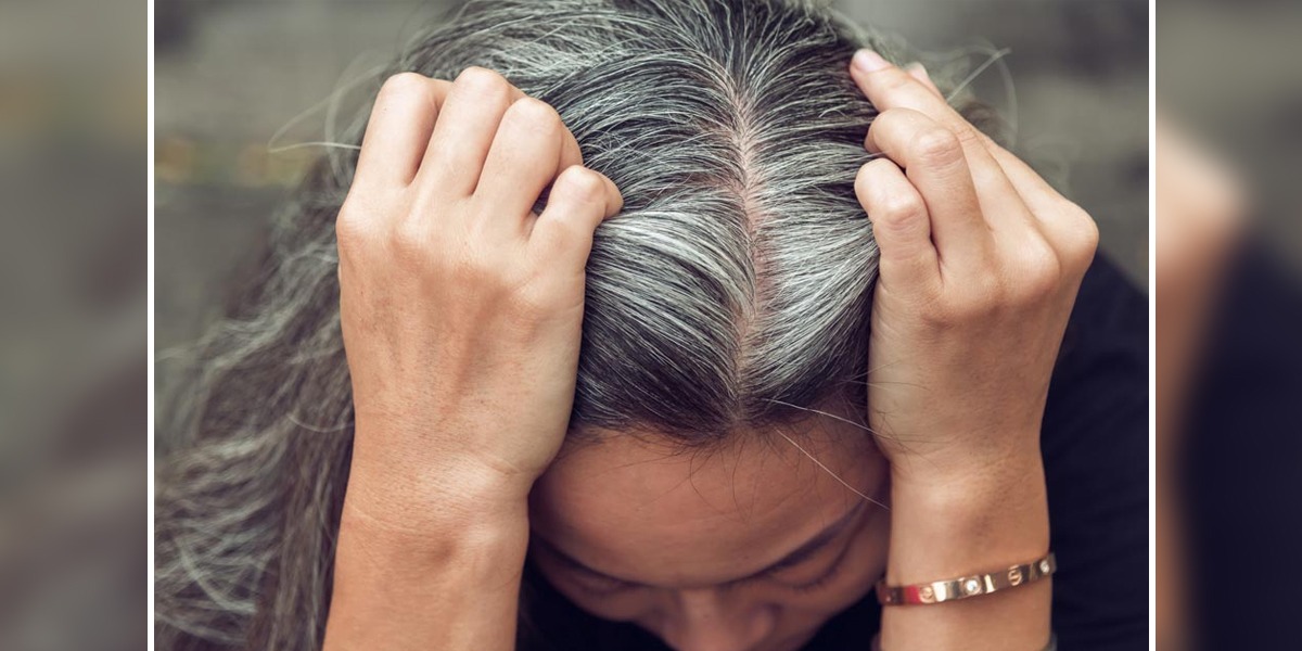 Greying of hair