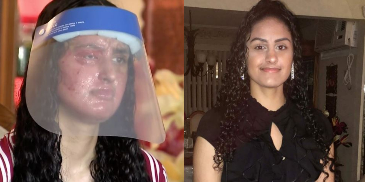 Nafiah Ikram Acid Attack