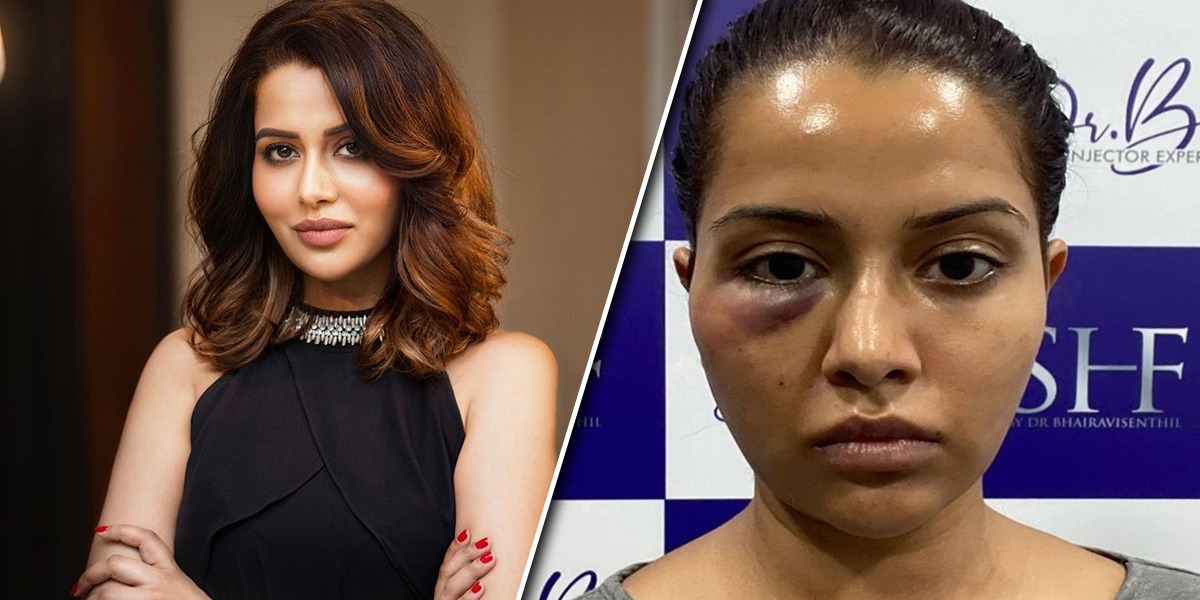 Raiza Wilson facial