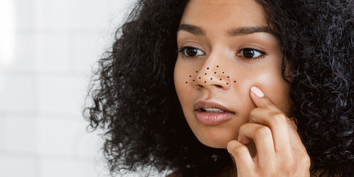 Now no more Difficulty in Removing Blackheads with this Homemade Scrub