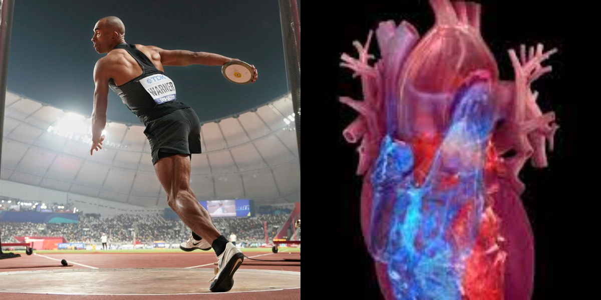 COVID-19 could cause heart problems in young athletes