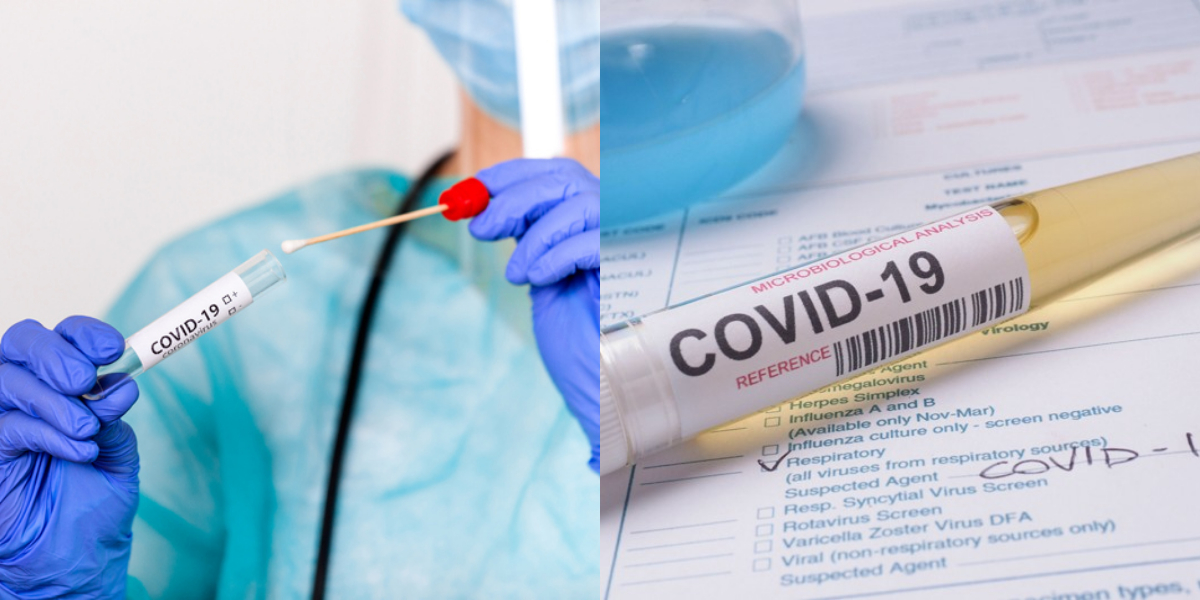 S. Africa's biggest laboratories agree to reduce PCR tests costs