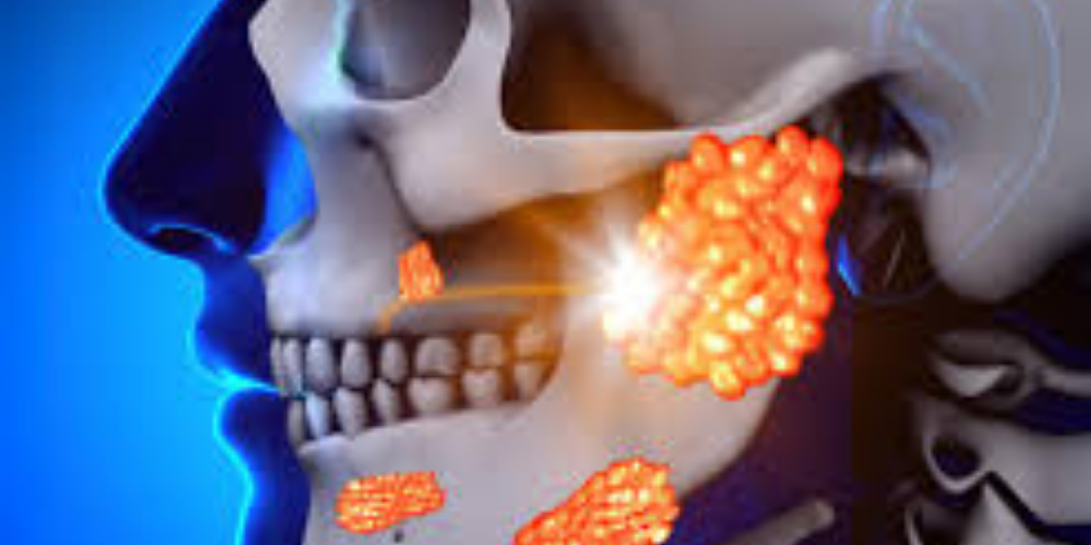 Mumps cases in vaccinated people are rising and the reason is not clear