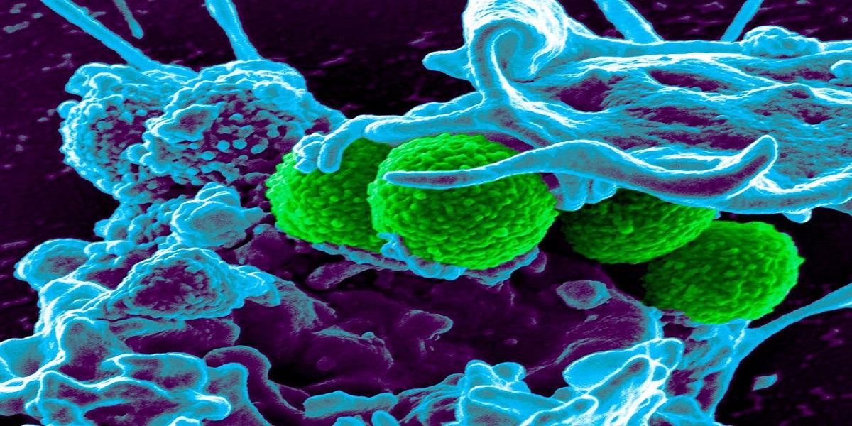 Aussie researchers develop new copper surface to help combat antibiotic-resistant superbugs