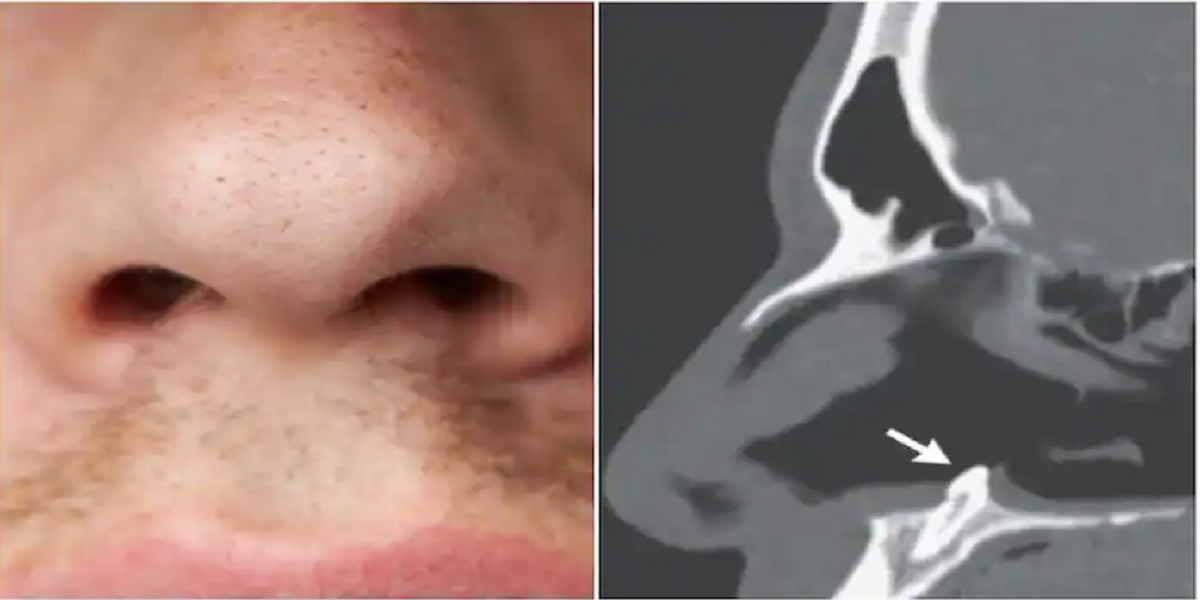 Breathing