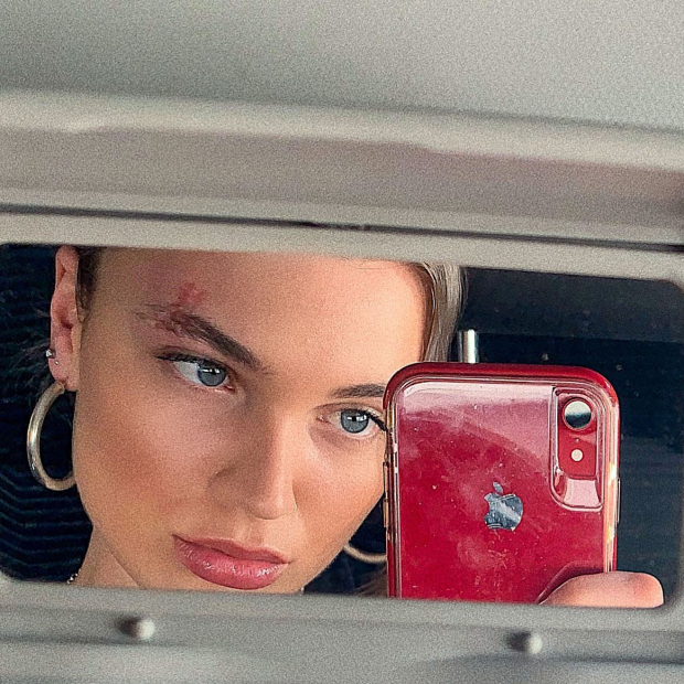 model