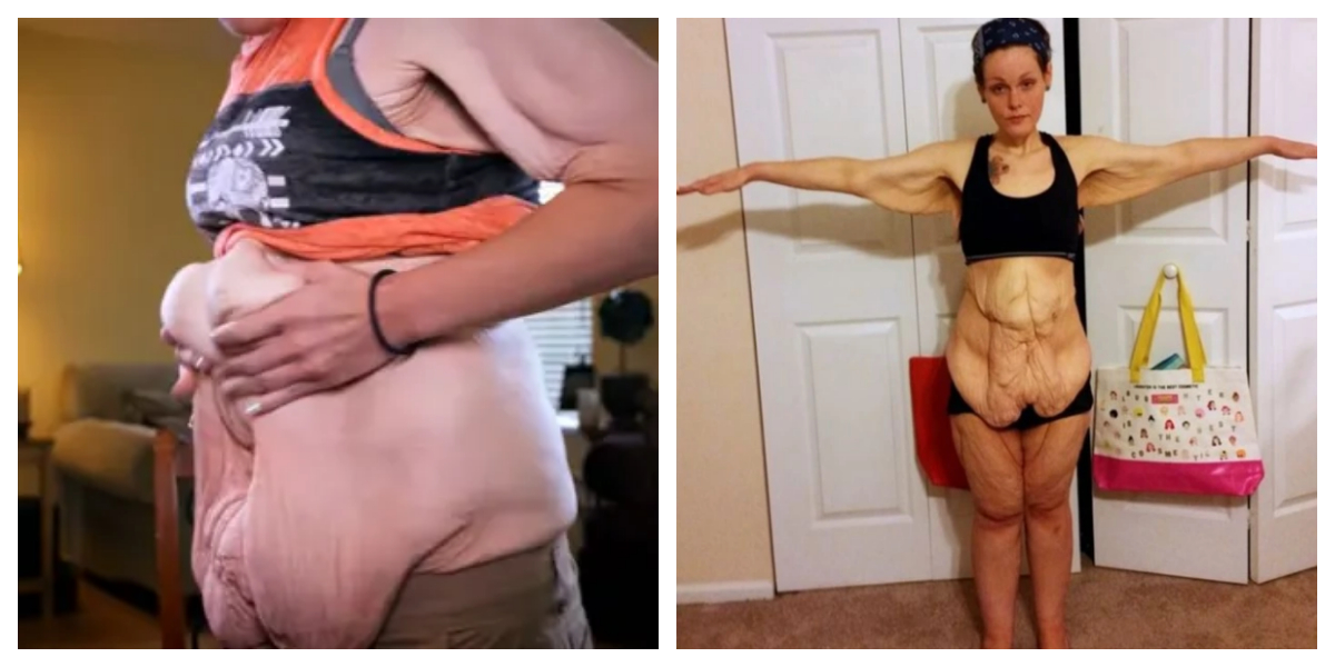 body