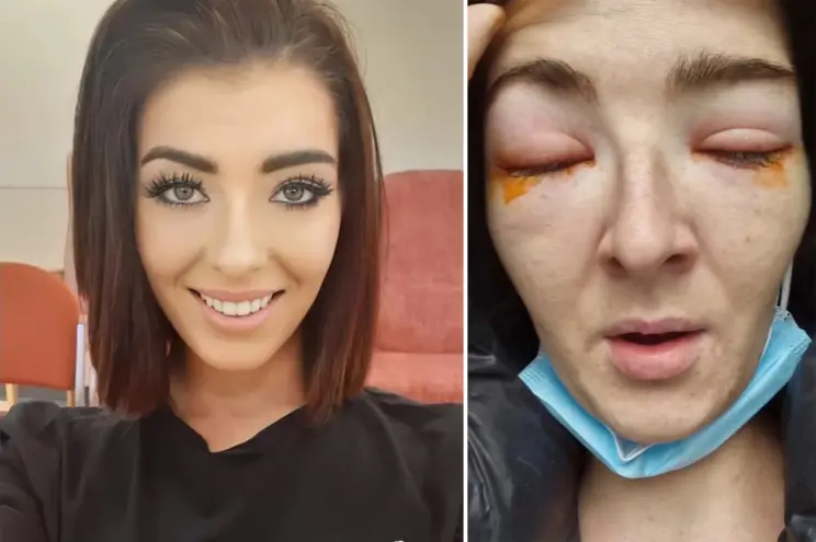 Eyelash extensions