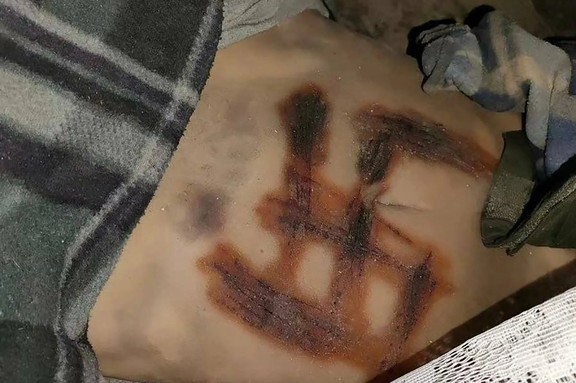 swastikas