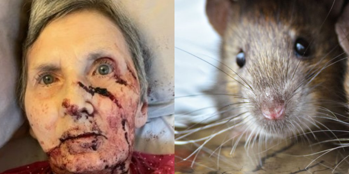 A 76-year old disabled woman was attacked by a rat