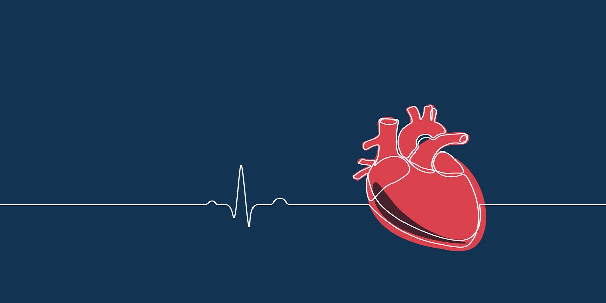 organ donation