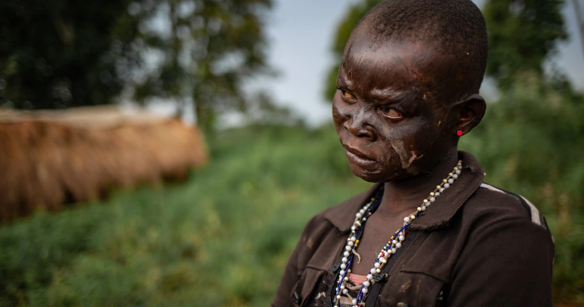 Congo