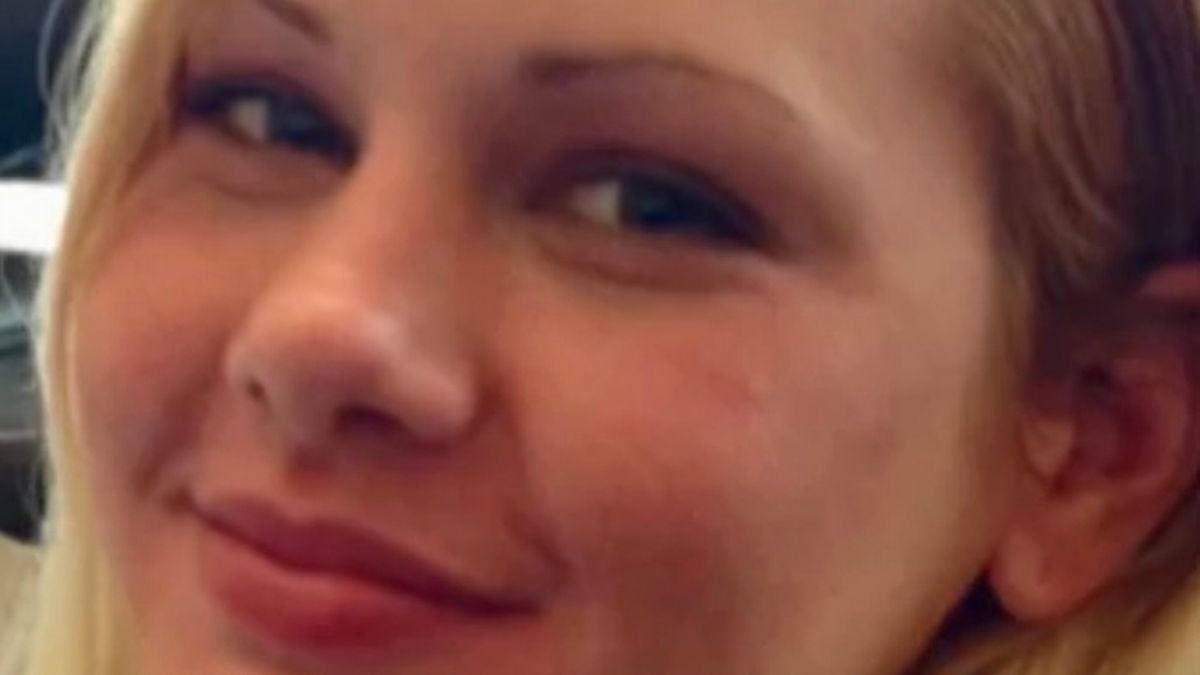 woman face burned