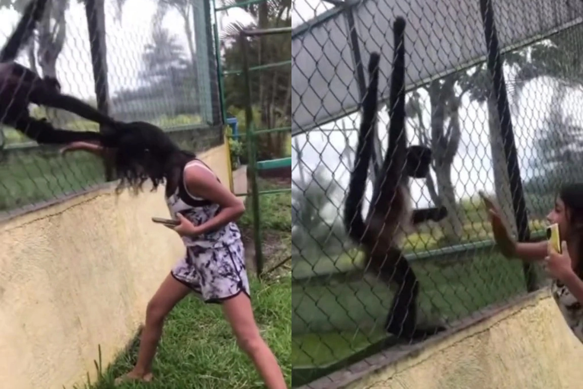GIRL nearly loses her scalp