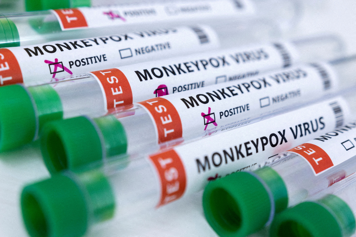 monkeypox outbreak