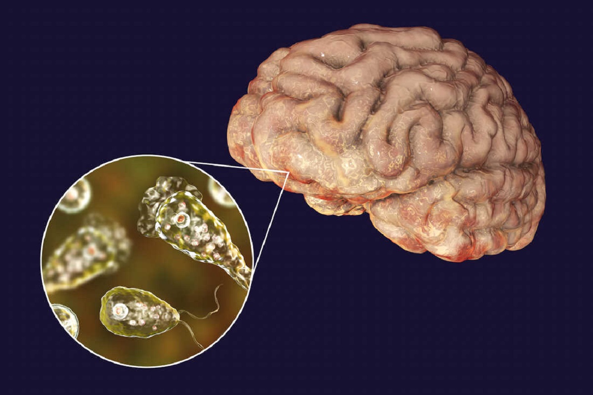 brain-eating amoeba