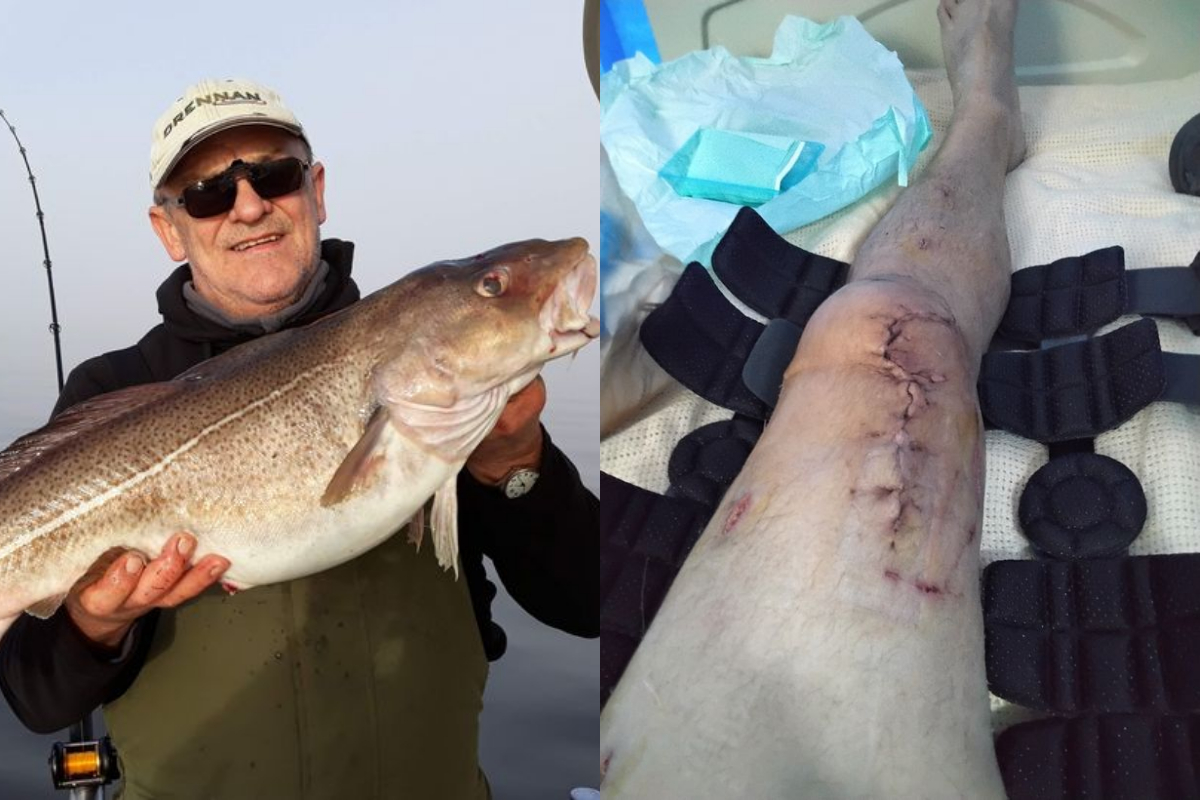 Fisherman hit
