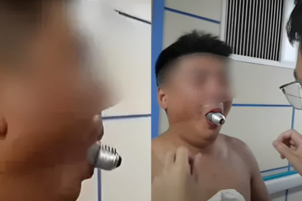 Man Finds Himself with Light Bulb Stuck in Mouth