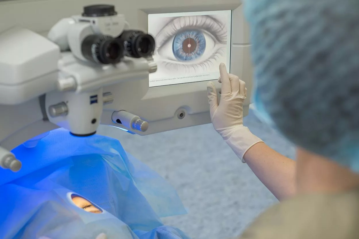 AI improves cataract surgery outcomes for LASIK patients