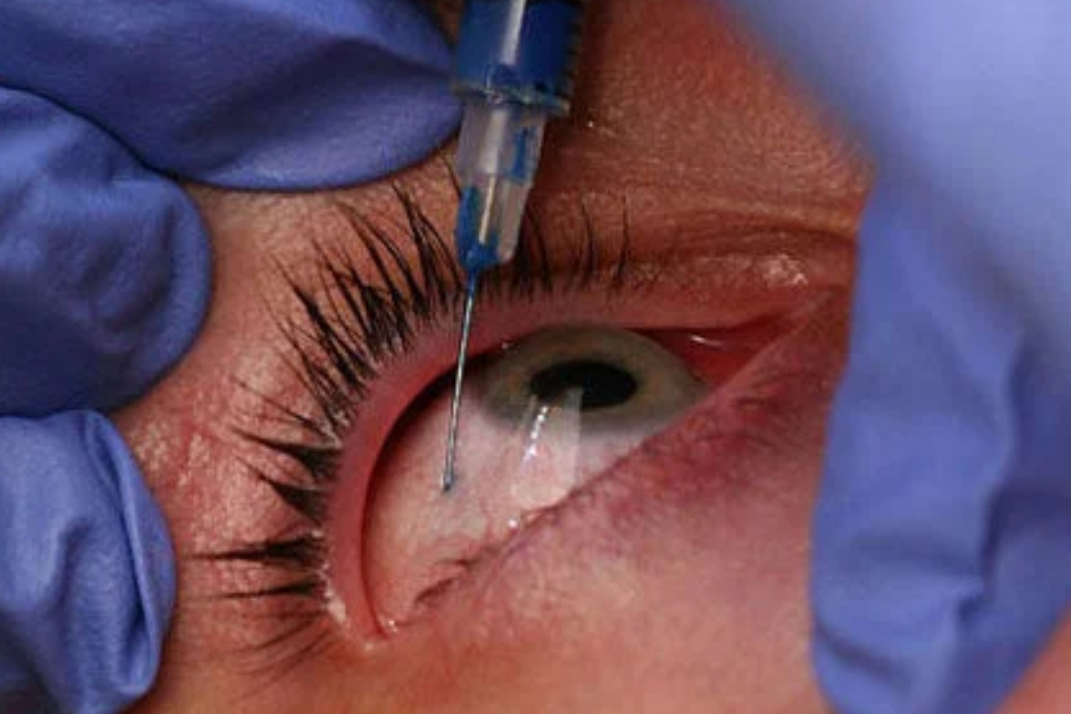 Avastin injection
