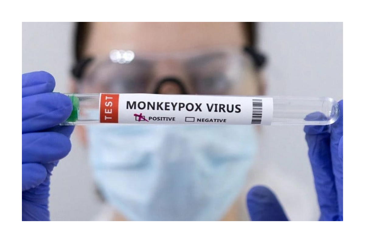 monkeypox cases