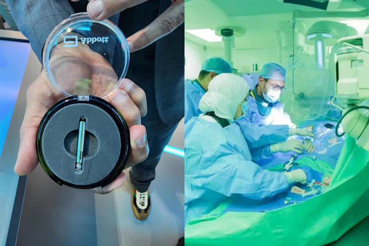 UAE: Matchstick-sized pacemaker requires no surgery, lasts for 25 years