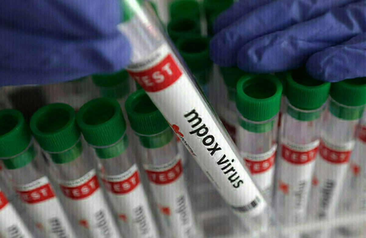 Mpox