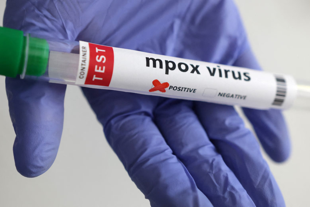Mpox