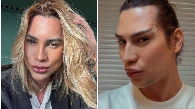 Brazilian style icon dies after ‘Fox Eyes’ surgery complications