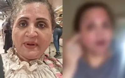 Asma Abbas’s beauty treatment gone wrong, spoiling the whole face