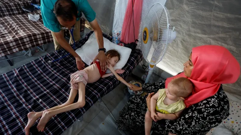 Gaza malnutrition