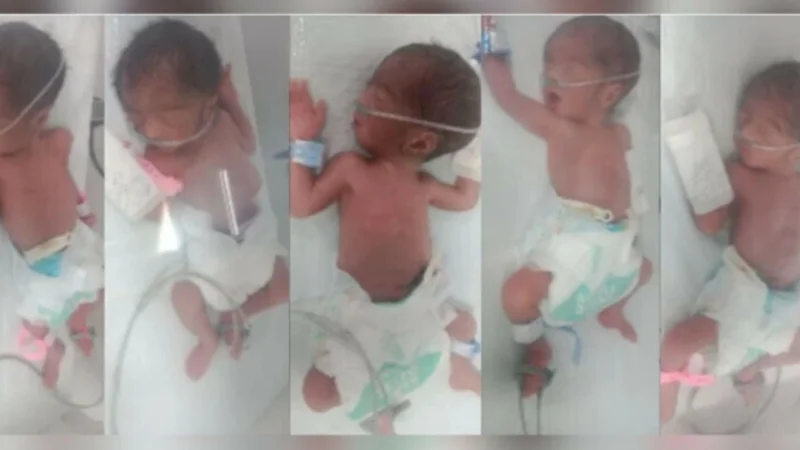 Quintuplets born to Karachi resident through emergency