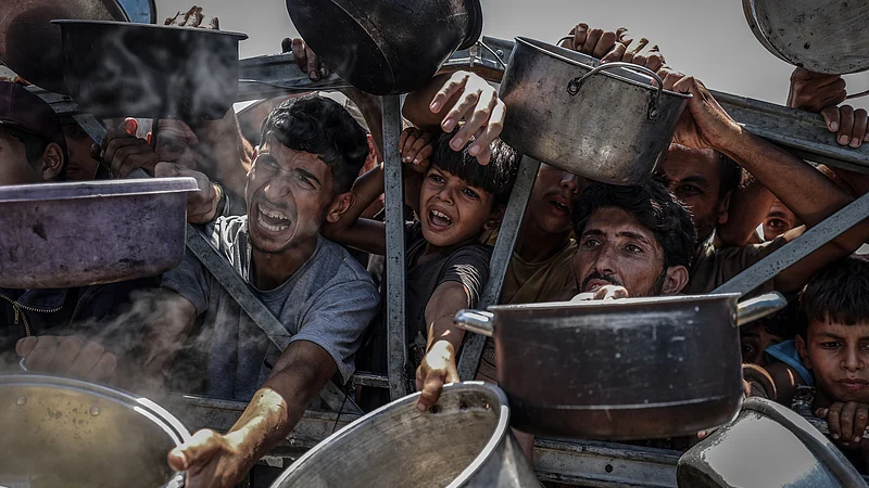 GAZA MALNUTRITION