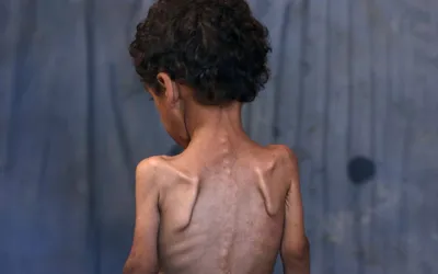 Britain, France, and Germany demands for immediate end to Gaza humanitarian crisis