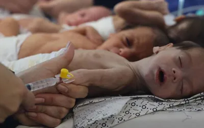 WHO condemns worsening malnutrition crisis in Gaza