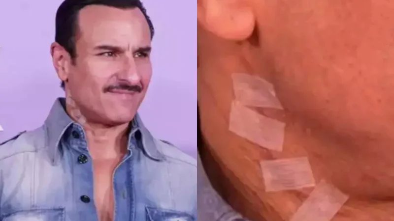Saif Ali Khan’s visible neck scars go viral in first public appearance after attack