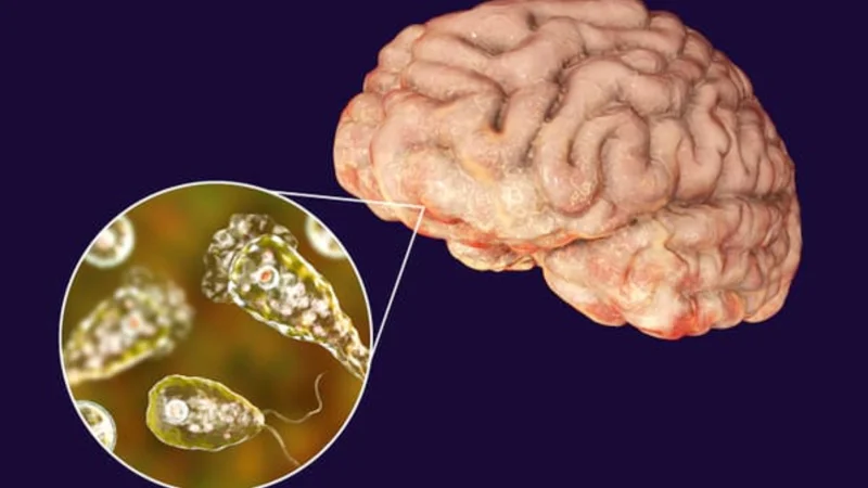 Naegleria Fowleri claims woman life in Karachi