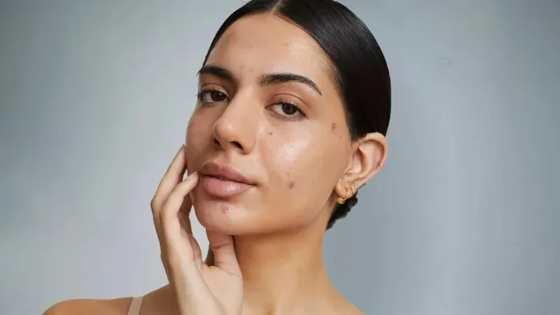 How daily skincare habits can help prevent facial dark spots - dark spot, skin specialist, Skincare