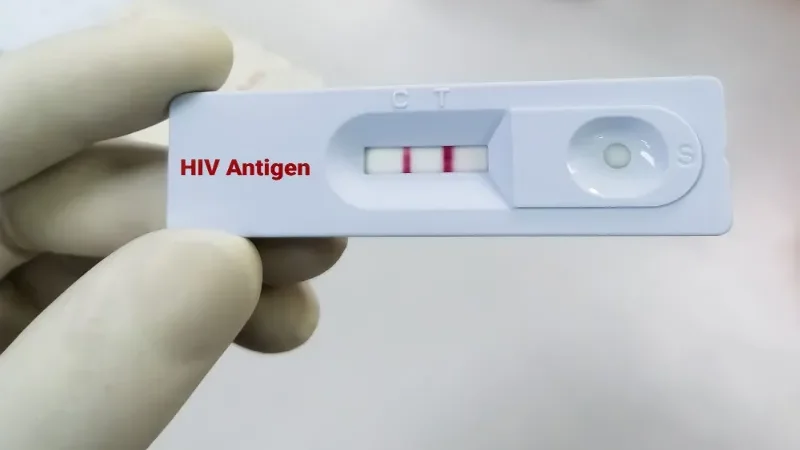 HIV