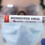 EU health agency urges Europe to prepare for more Monkey pox cases