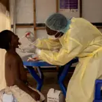 WHO official dismisses Mpox as new COVID variant