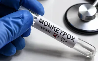 KP confirms third Monkeypox Case