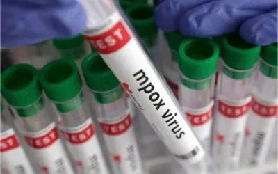 UNICEF seeks urgent Mpox vaccine supplies through emergency tender